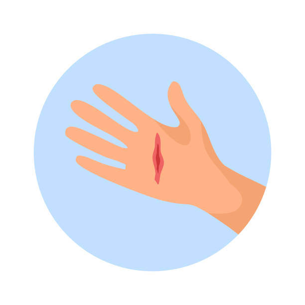 Cut injury with red blood on palm in flat design. Wound on hand concept vector illustration on white background. Cut injury with red blood on palm in flat design. Wound on hand concept vector illustration on white background. knife wound illustrations stock illustrations