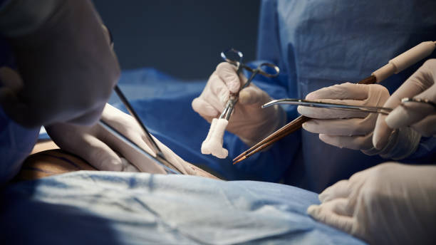 Medical team doing plastic surgery in operating room. Surgical team in blue suits using medical instruments and performing surgical operation. Close up surgeon and assistants doing cosmetic surgery in modern clinic. Concept of medicine, plastic surgery. porous sponge stock pictures, royalty-free photos & images