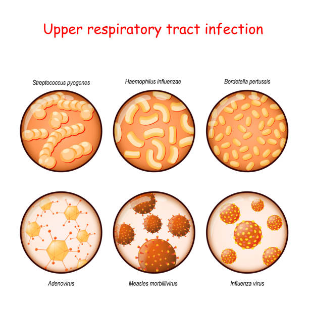 respiratory infection Upper respiratory tract infection. Close-up of causative agents of tonsillitis, nasal obstruction, sore throat, pharyngitis, laryngitis, and sinusitis: Viruses (Adenovirus, Influenza, Measles morbillivirus), and bacteria (Bordetella pertussis, Haemophilus influenzae, Streptococcus pyogenes). Vector illustration measles illustrations stock illustrations