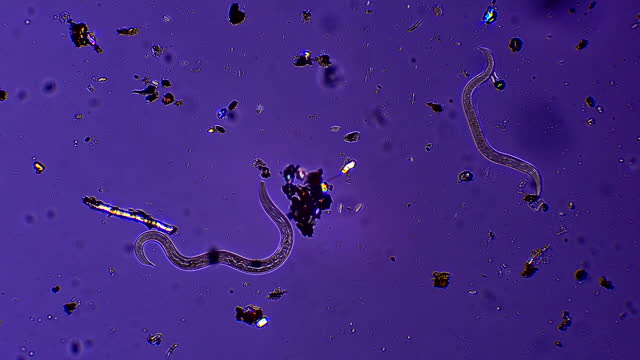 Nematode worms, microscopic magnification