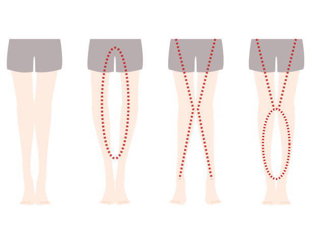 Comparison And Distortion Of Olegs And Xlegs Stock Illustration - Download Image Now - Low Section, Illustration, Women - iStock