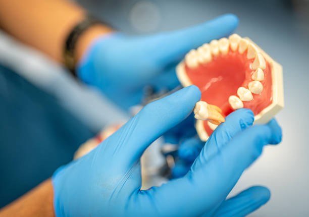 istock Dental prosthesis, dentures, prosthetics work. Prosthetics hands while working on the denture. 1288609248