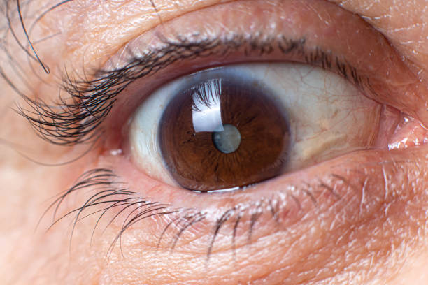 foto macro dell'occhio umano - annebbiamento della cataratta della lente, deterioramento della vista. trattamento, chirurgia e oftalmologia - doctor old male family foto e immagini stock