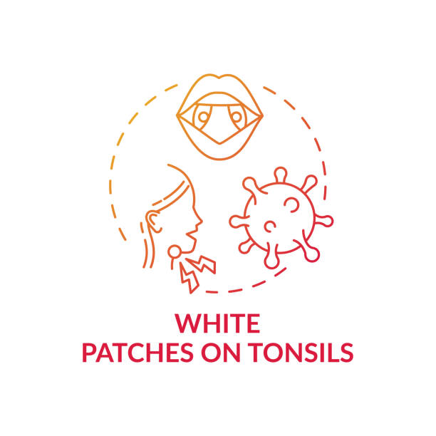 White patches on tonsils concept icon White patches on tonsils concept icon. Tonsillitis sign idea thin line illustration. White pus-filled spots. Strep throat and pneumococcus. Calcium deposits. Vector isolated outline RGB color drawing tonsil stock illustrations