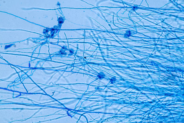 penicillium, hongos ascomycetous son de gran importancia en el medio natural, así como la producción de alimentos y medicamentos. - penicillium fotografías e imágenes de stock