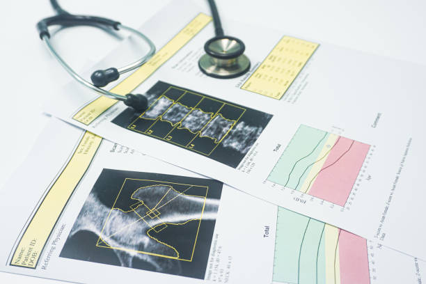 close up stethoscope  put on a bone density hip and spine report.too soft and blurry image - healthcare and medicine stethoscope patient report imagens e fotografias de stock