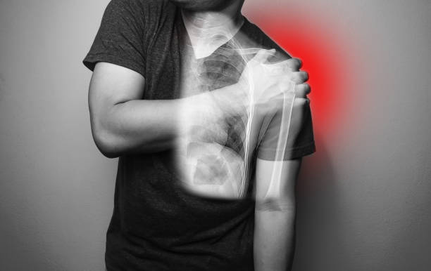 男性の肩と上腕骨骨折の痛みをクローズアップ, 痛み肩の炎症症状医療の概念で肩を保持する若い男 - men anatomy the human body body ストックフォトと画像