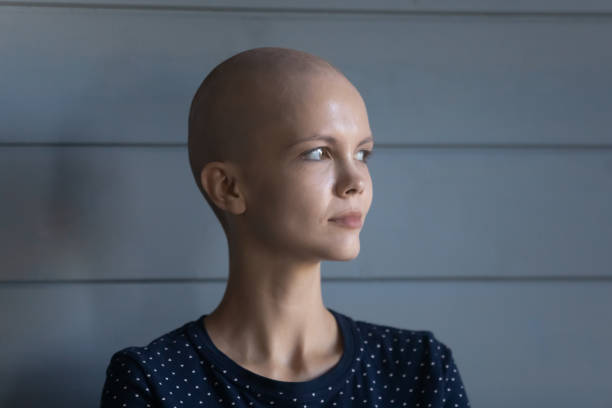 istock Concentrated young female diagnosed with oncology looking forward with courage 1289162254