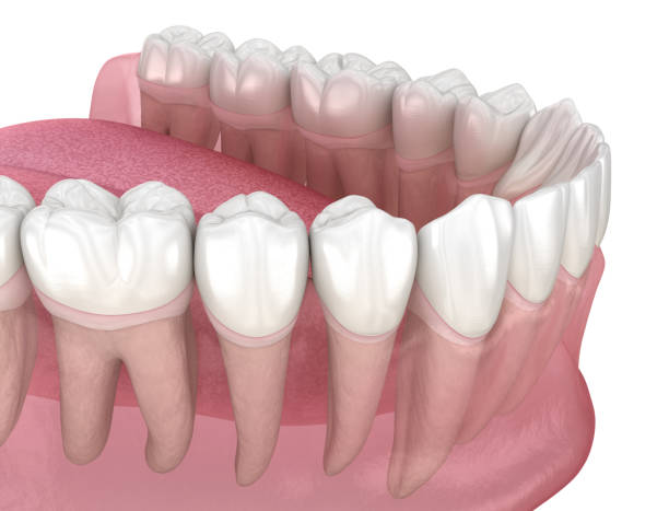 istock Morphology of human teeth. Medically accurate tooth 3D illustration 1289167674