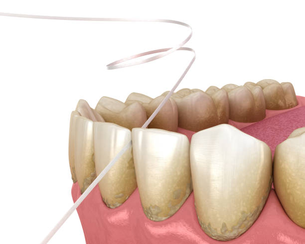 istock Dental floss cleaning process. Medically accurate dental 3D illustration 1289167793