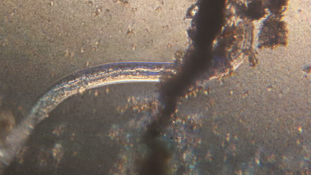 Microscopy of parasite worm nematode (Strongyloides stercoralis). Closeup movement of active parasite form in magnification 300x.