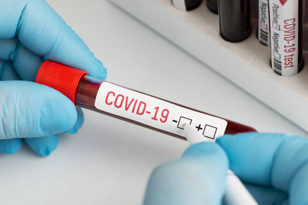 istock Doctor holding blood sample, putting check mark near negative symbol 1289569476