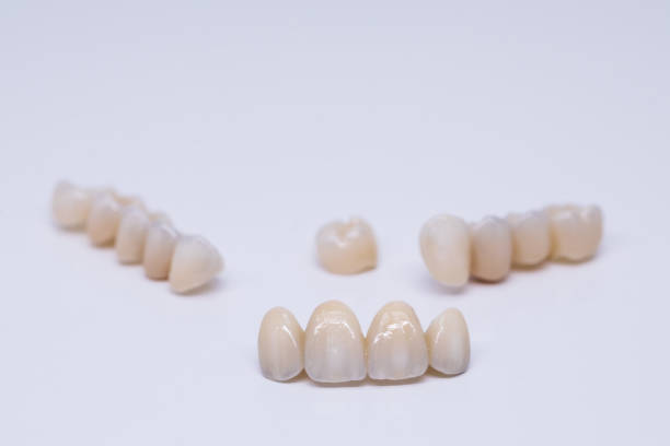 istock Metal Free Ceramic Dental Crowns. Ceramic zirconium in final version. Staining and glazing. Precision design and high quality materials 1289595296