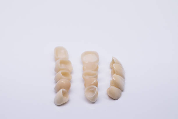 最終版のセラミックジルコニウム。メタルフリーセラミック歯科クラウン。ジルコニウム歯冠は、ワイトの背景に分離します。歯の損失の審美的回復 - dental hygiene laboratory dental equipment technician ストックフォトと画像