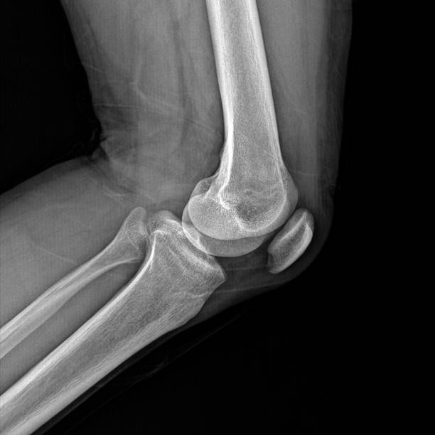 Sporting injury stock photo