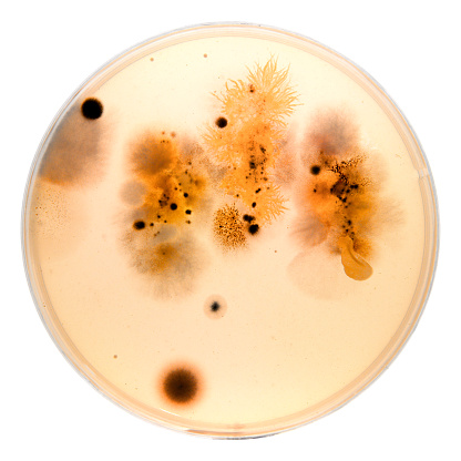 Backlit composition on white background of different microbes growing on colture media