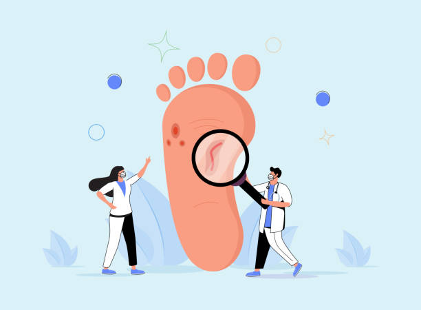 Podiatry as medicine brunch devoted to foot, leg, lower extremity and ankle tiny persons concept. Doctor surgical. Podiatry as medicine brunch devoted to foot, leg, lower extremity and ankle tiny persons concept. Doctor surgical treatment of disorders and diagnosis knowledge. Abstract patient inspection scene. doctor ankle stock illustrations