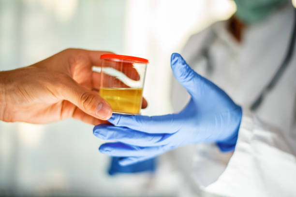 Man handing container with urine sample to a doctor Man handing container with urine sample to a doctor specimen holder stock pictures, royalty-free photos & images