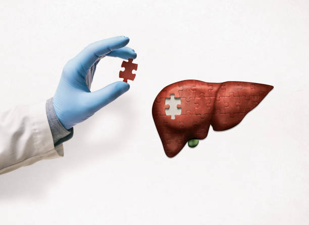 Liver treatment concept. Puzzle with illustration of liver and doctor's hand with the missing piece of puzzle. Liver treatment concept. liver organ stock pictures, royalty-free photos & images
