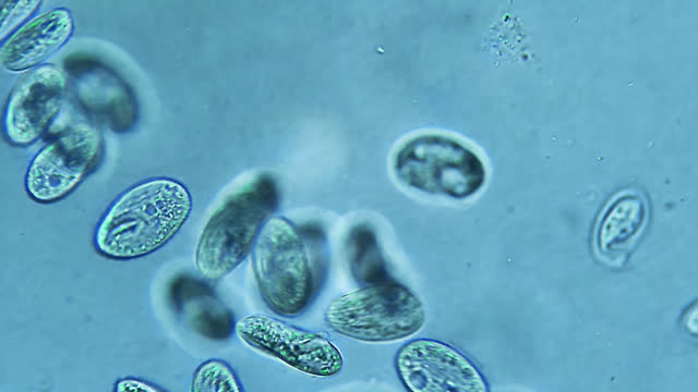 Colony of ciliates microorganisms floating in water