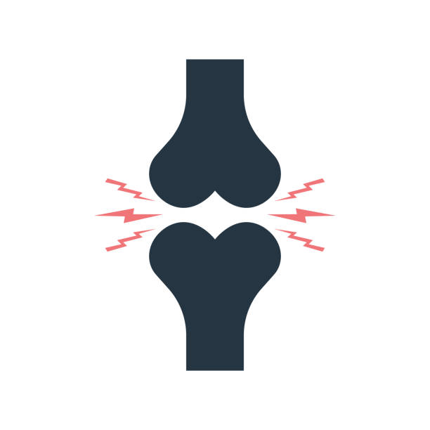Icon of bone joint with pain. Arthritis of knee. Logo of rheumatology or osteoporosis. Symbol of skeleton, orthopedic care and anatomy. Pain in leg after inflammation, cracking and fracture. Vector Icon of bone joint with pain. Arthritis of knee. Logo of rheumatology or osteoporosis. Symbol of skeleton, orthopedic care and anatomy. Pain in leg after inflammation, cracking and fracture. Vector. fractured foot drawing stock illustrations