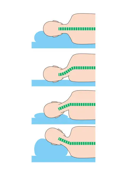 Vector illustration of Pillow height and neck strain