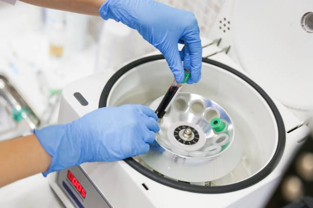istock extraction of plasma from blood. 1290459313