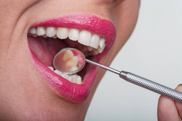 istock Going to the dentist for a pretty healthy smile 1290468378