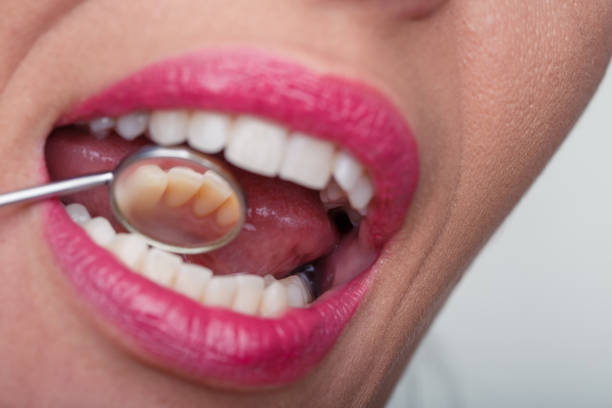 istock Going to the dentist for an longlasting smile 1290468398