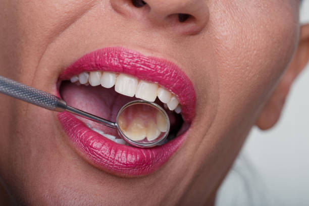 istock Going to the dentist for a healthy white smile 1290468410