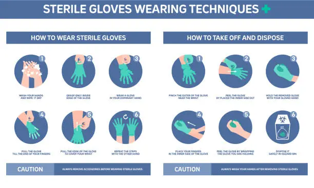 Vector illustration of Infographic illustration of Sterile gloves wearing techniques, how to wear gloves. Flat design.