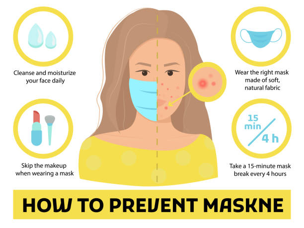 wie man maskne-tipps vorbeugen - akne oder reizung durch das tragen von schützender gesichtsmaske während coronavirus pandemie verursacht. infografik vektor-illustration isoliert mit weiblichen charakter porträt. frau gesicht mit pickeln - human face washing cleaning body care stock-grafiken, -clipart, -cartoons und -symbole