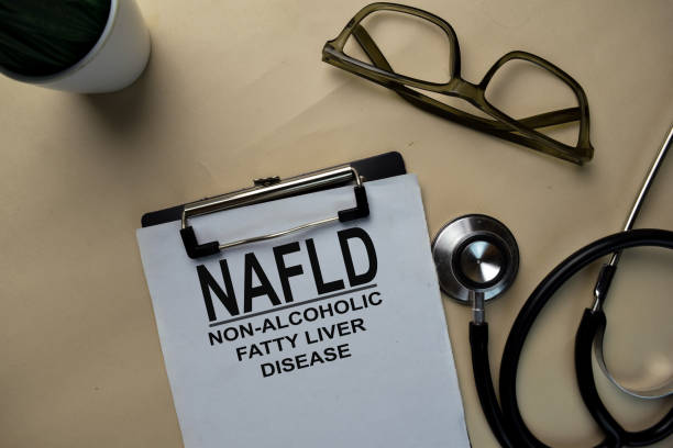 istock NAFLD - Non-Alcoholic Fatty Liver Disease write on a paperwork isolated on office desk. 1290964329