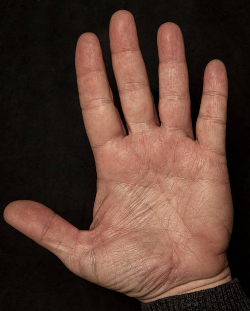 istock palm of hand 1291072930