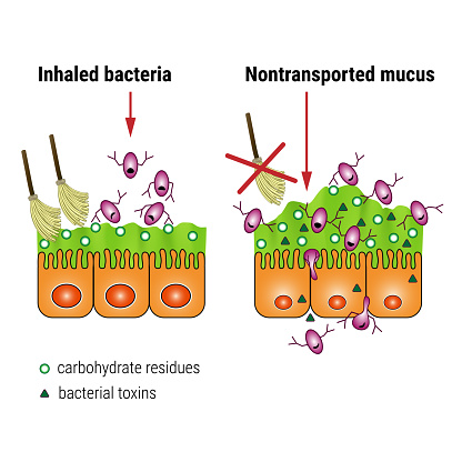Bacterial interaction with respiratory mucus. Mucociliary transport. Respiratory pathogens release factors. Medical vector illustration