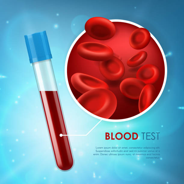 ilustrações de stock, clip art, desenhos animados e ícones de blood test vector medicine poster with 3d red cell - microscope view