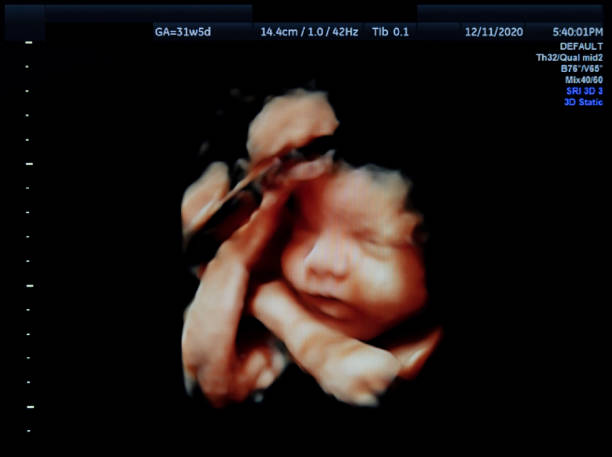 Ultrasound in 4D HD 4D HD pregnancy ultrasound of a baby at 31 weeks in vitro fertilization photos stock pictures, royalty-free photos & images
