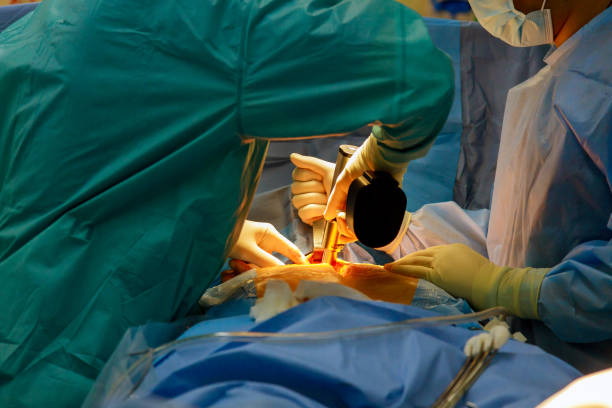Surgeon with surgical instrument during the open heart operation Surgeon themselves inside the wound with surgical instrument during the open heart operation aorta photos stock pictures, royalty-free photos & images