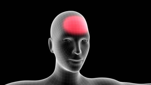3d illustration of a woman xray hologram showing pain area on the head area stock photo