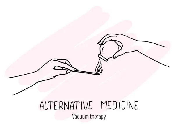 Vector illustration of Therapeutic manipulations for vacuum procedures at home.