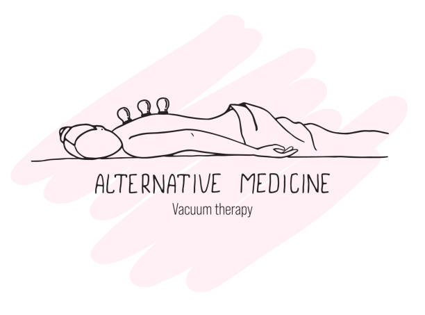 The girl is undergoing vacuum therapy. Alternative medicine. The girl is undergoing vacuum therapy. Alternative medicine. Doodle. cupping therapy stock illustrations