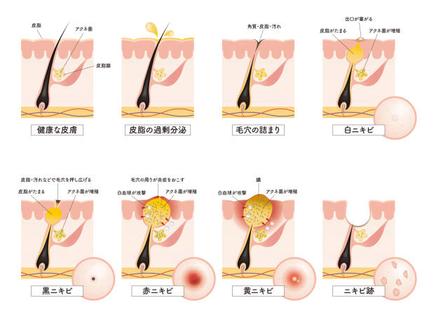 Cross section of the skin 15 front Cross section of the skin 15 front papilla stock illustrations