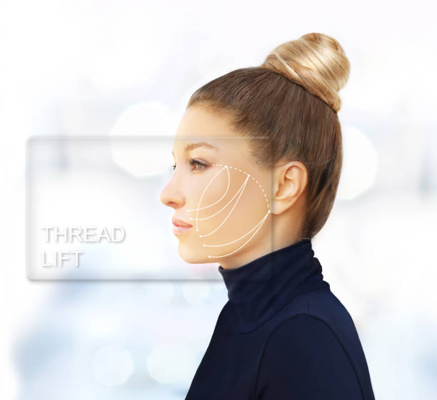thread lift procedure ,non-surgical facelift,markup