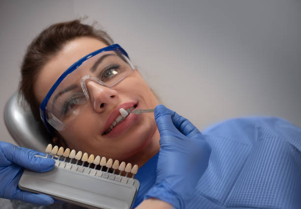 치과 의사를 방문하는 동안 보호 안경을 쓴 젊은 여성의 클로즈업. 치과 의사는 환자의 치아의 백색도정도를 샘플과 비교합니다. 의료 장비로 표백 미백 과정을 설명하는 의사 - dentist office work tool hygiene mirror 뉴스 사진 이미지