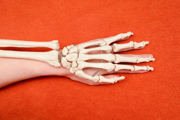 istock Hand bones on top of human hand on orange background, dorsal side view, anatomy example, medicine studies 1292079916