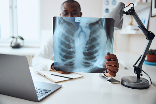 Medical worker stretching his arm with a chest film and carefully examining it while sitting at his desk