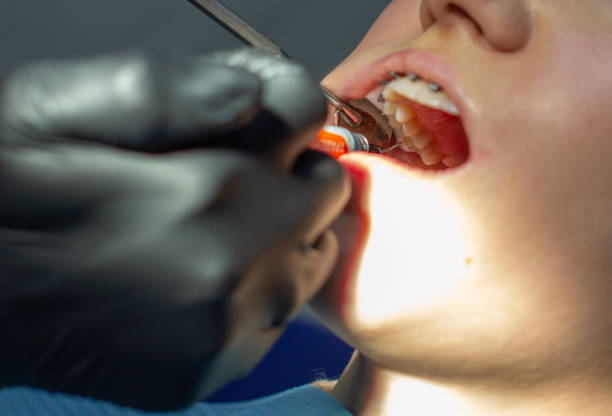 istock A woman at a dentist's appointment to replace arches with braces. 1292254836