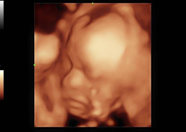 3D 4D Baby Fetal Ultrasound image (Three dimensional Fetus of 20 weeks of pregnant women) 3D 4D Baby Fetal Ultrasound image (Three dimensional Fetus of 20 weeks of pregnant women) human embryo photos stock pictures, royalty-free photos & images