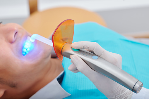 Close-up image of dentist using curing light is a piece of dental equipment that is used for polymerization of light cure resin based composites