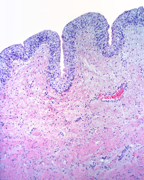 Urinary bladder mucosa Mucosa of the urinary bladder formed by a transitional epithelium and a lamina propria of connective tissue. Below, the muscular layer formed by smooth muscle fibers begins urothelium stock pictures, royalty-free photos & images